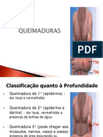 QUEIMADURA