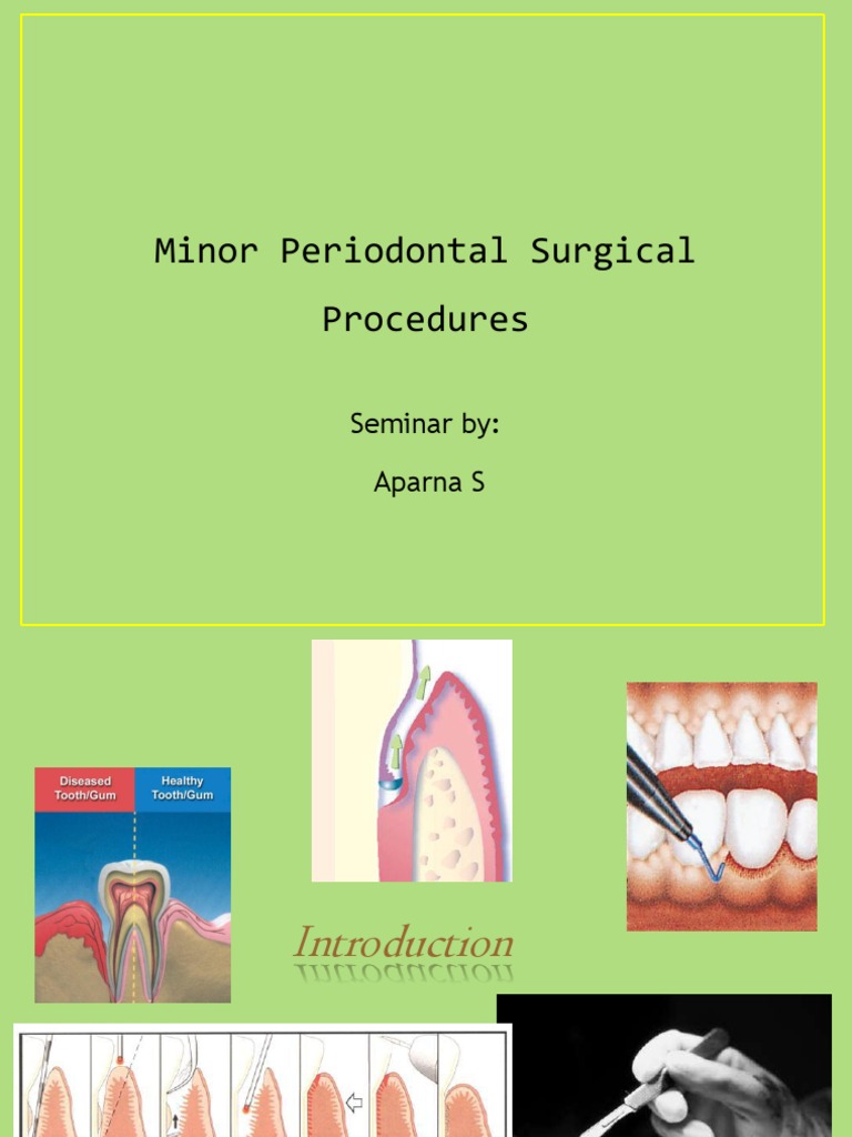 Gingivectomy Seminar Periodontology Dentistry Branches