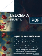 Leucemia Infantil