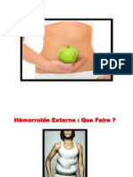 Hemoroide Interne, Symptome Hemoroide, Remede Contre Les Hemorroides, Les Hemoroide