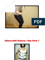 Comment Soigner Les Hemorroides, Hémorroïdes Traitement, Suppositoire Hemorroides, Emoroid