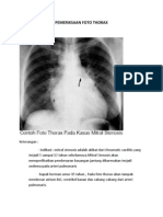 Pemeriksaan Foto Thorax