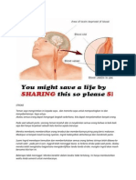 Cara-Cara Mengesan STROKE