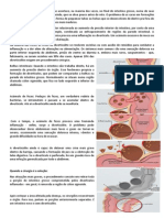 A Diverticulite É Uma Inflamação Que Acontece Trabalho