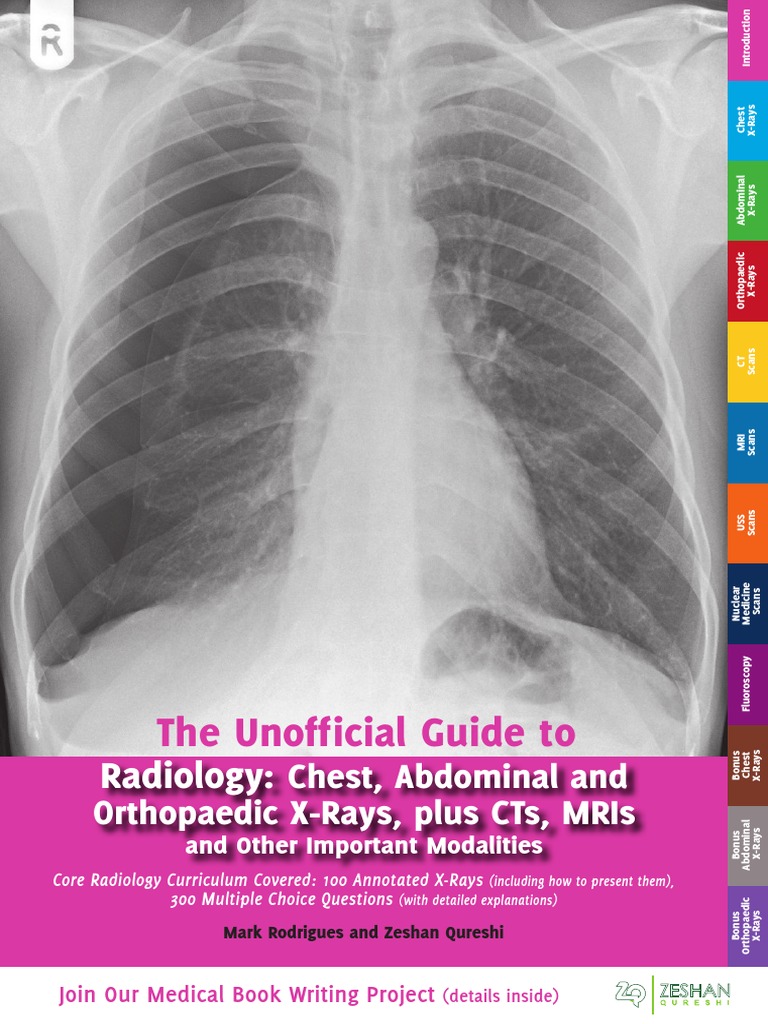 Unofficial Guide To Radiology | PDF | Ct Scan | Medical Imaging