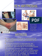 artritisyartrosis1-1228089065672583-8