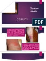 Celulitis