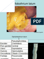 Diphyllobothrium Latum