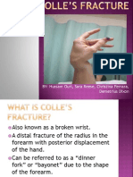 Colles Fracture Care