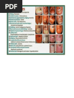 Alterações Nas Unhas e Suas Patologias (Desordens Orgânicas)