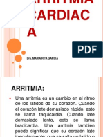 Arritmia Cardiaca