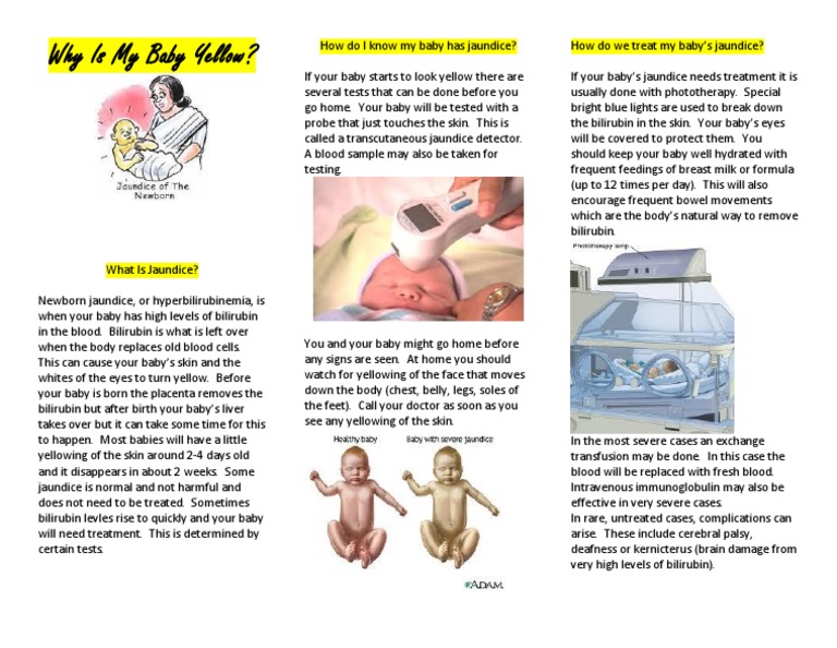 Home Care For Jaundice Baby