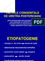 Valvele Congenitale de Uretra Posterioara