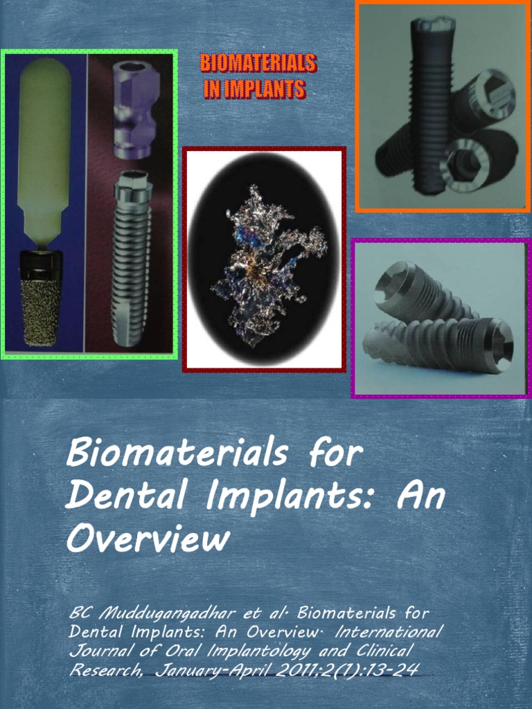 Biomaterials for Dental Implants Titanium Corrosion