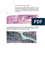 14.la Capsulitis Adhesiva