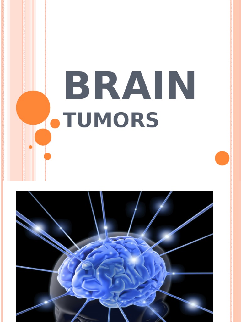 Brain Tumors: Types and Management | PDF | Brain Tumor | Headache