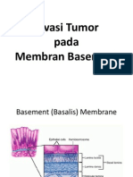 Invasi Tumor Pada Membran Basemen