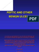 Peptic and Other Benign Ulcers