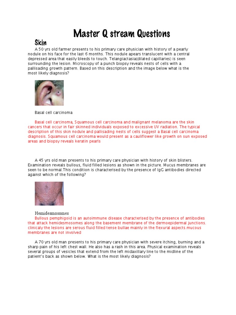 Master Q Stream Questions, AUA | PDF | Medical Specialties | Diseases ...
