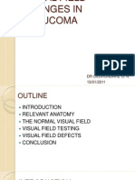 Visual Field Changes in Glaucoma