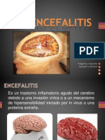 ENCEFALITIS