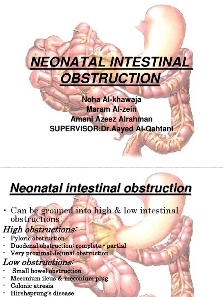 Neonatal Intestinal Obstruction Overview | PDF | Pancreas ...