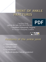 Ankle Fractures - Principles of Management
