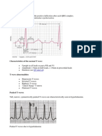 T Wave / T Talas