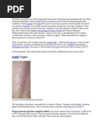 Download psoriasis by denaturals SN22245041 doc pdf