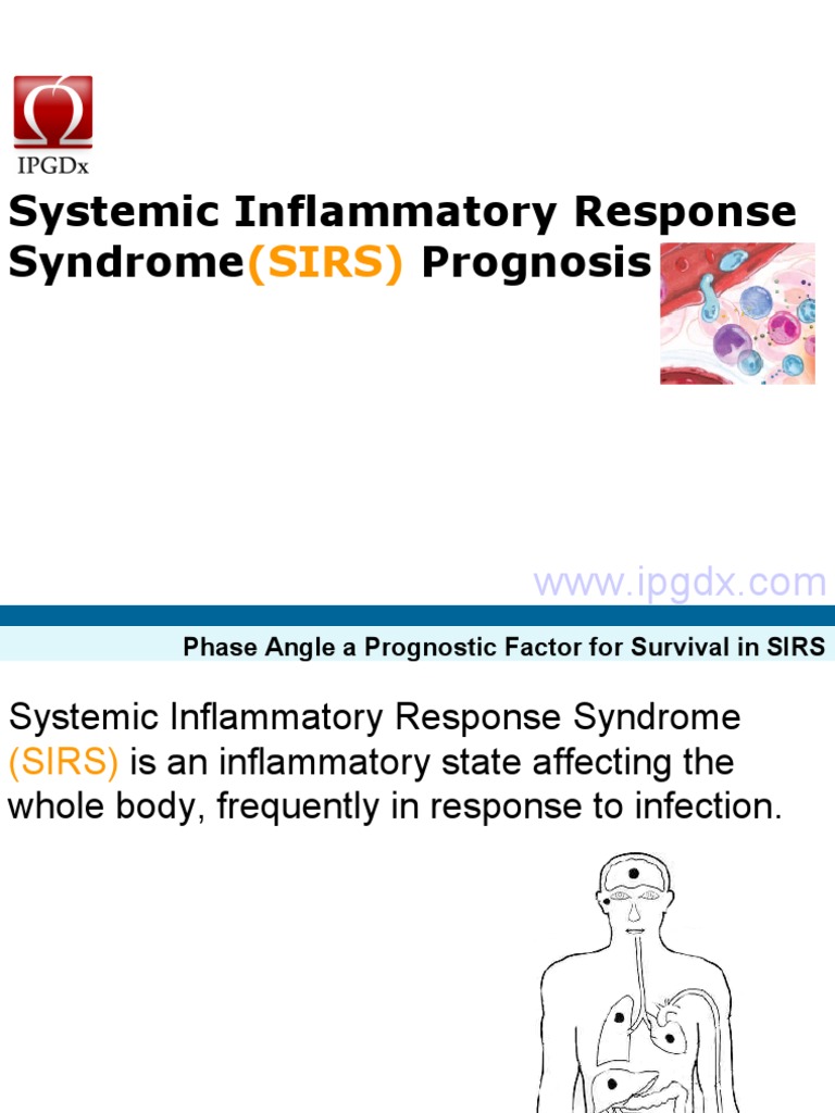 Systemic Inflammatory Response Syndrome (SIRS) Prognosis Sepsis