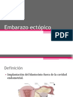 Embarazo Ectópico