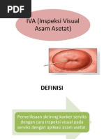 Download IVA Inspeksi Visual Asam Asetat by Evi Puspa SN222596669 doc pdf