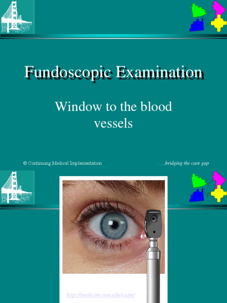 Fundoscopic_Examination.ppt Retina Ophthalmology