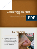 Cancer Basocelular y Epidermoide