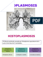 Micosis causada por Histoplasma capsulatum