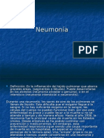 Neumonia