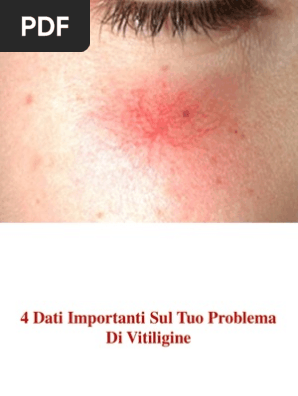 macchie rosse sul viso rimedi naturali