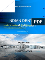 Arch Expansion in Orthodontics / Orthodontic Courses by Indian Dental Academy