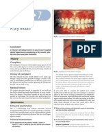 Dry Mouth Case Study: Diagnosing Sjögren's Syndrome