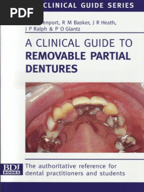 A Clinical Guide To Removable Partial Dentures Mouth Dentistry