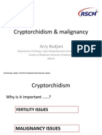 Cryptorchidism & Malignancy