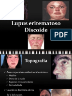 Lupus