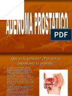 ) Adenoma Prostatico