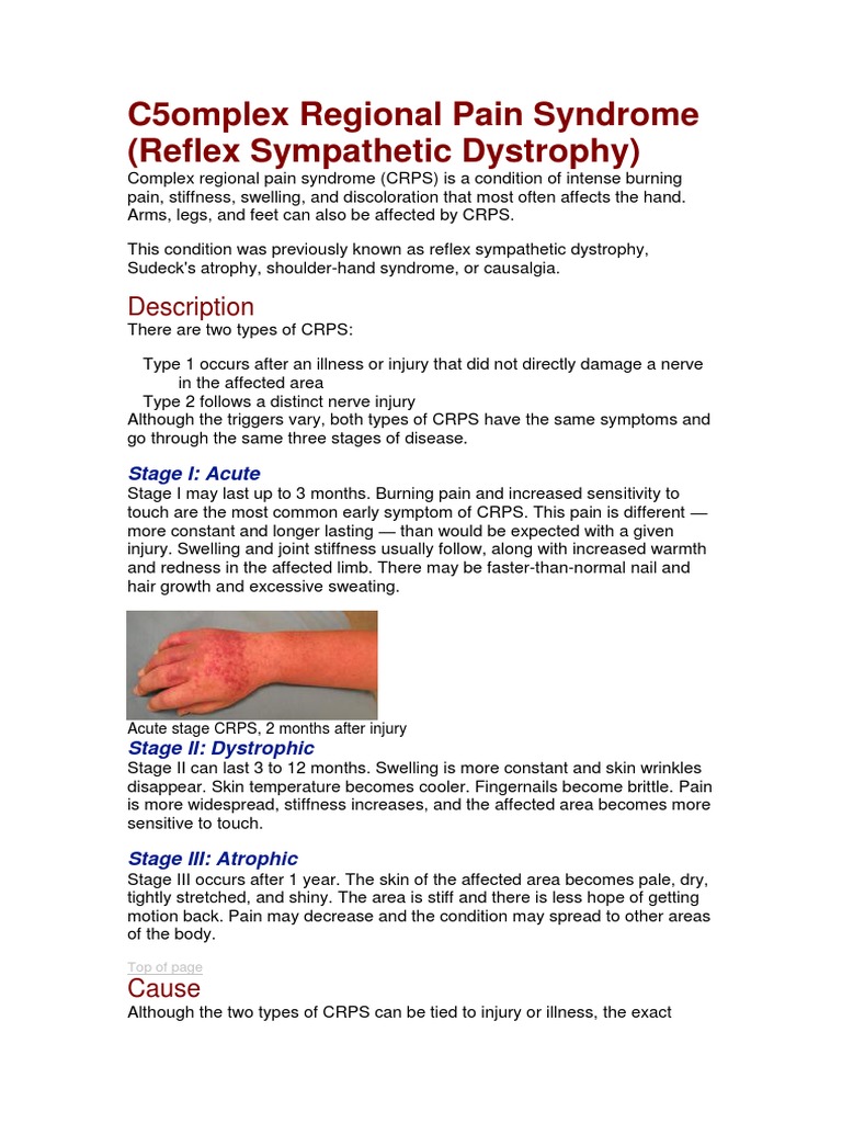 5. Reflex Sympathetic Dystrophy Clinical Medicine Medicine