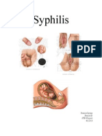 Syphilis: Jessica Lyons Period D STD Project 4/22/13