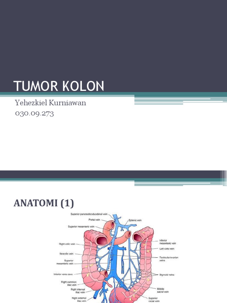 Tumor Kolon Pdf