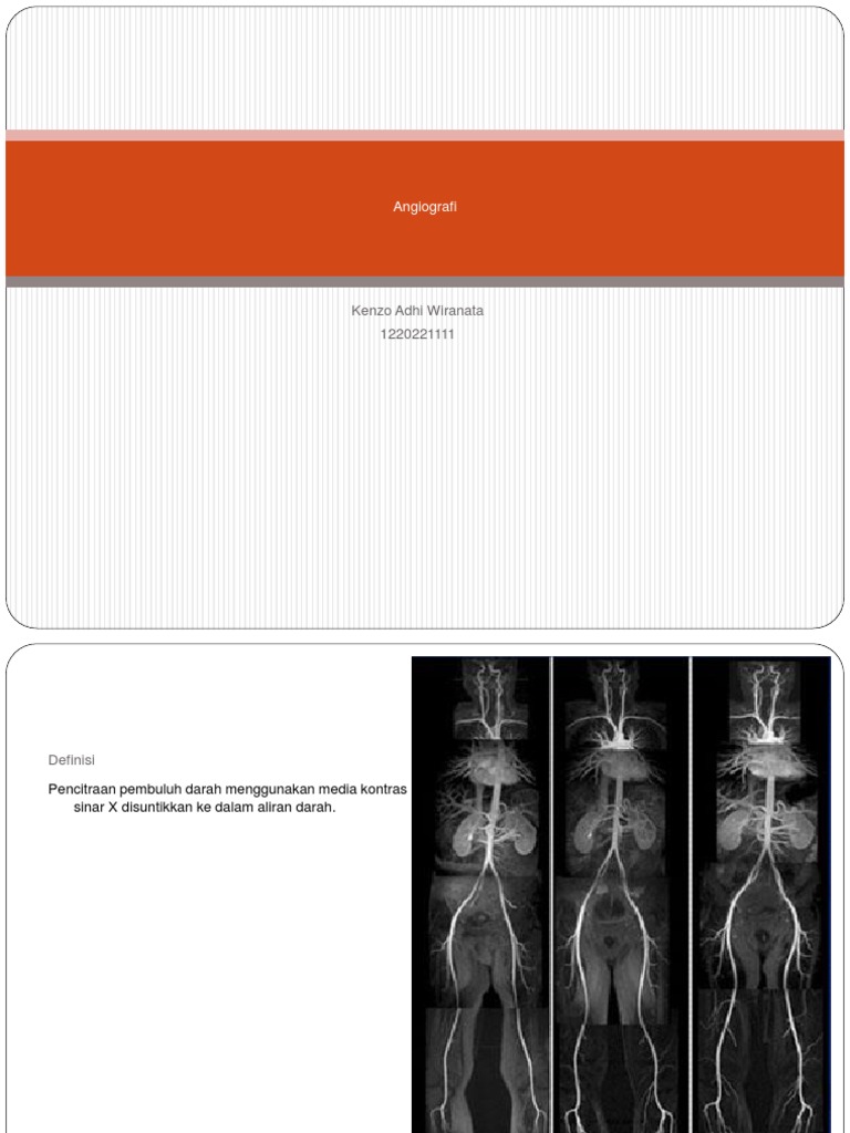 Prosedur dan Indikasi Angiografi | PDF