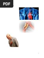 Download Coronary Artery Disease by glenn072589 SN22446179 doc pdf