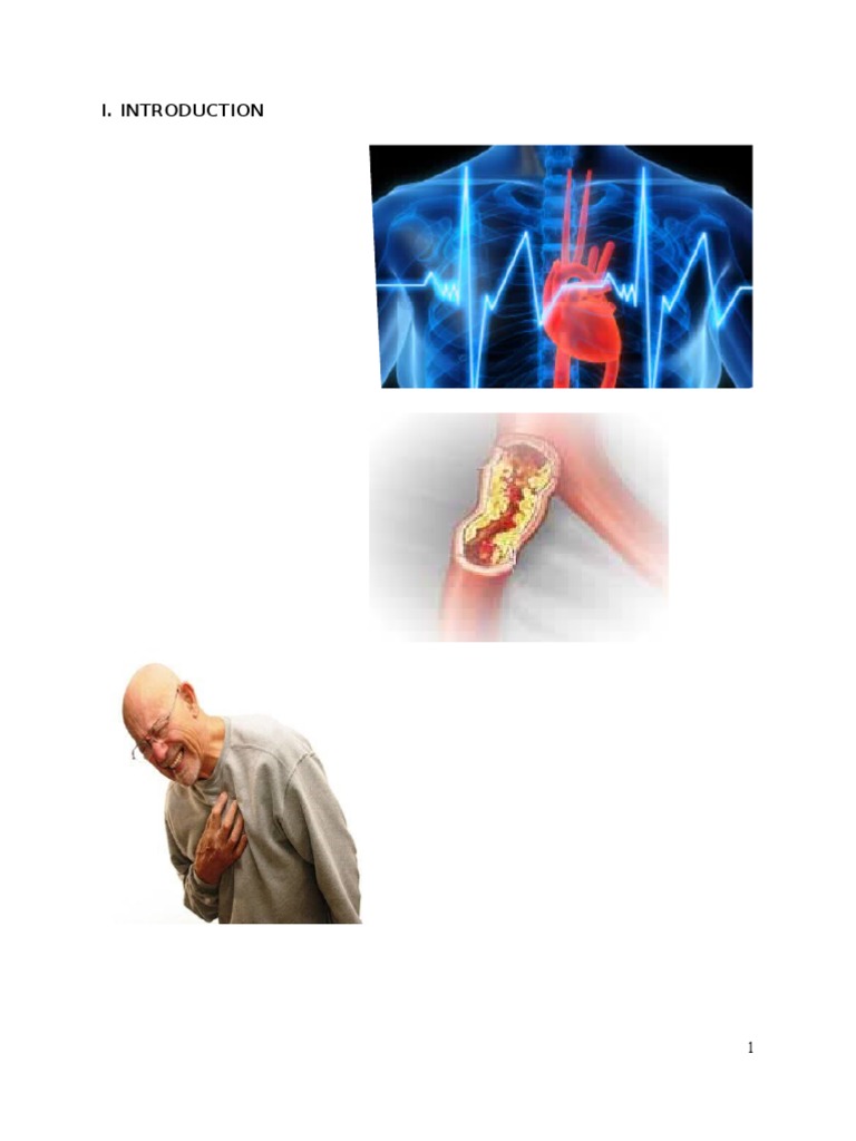 Understanding Coronary Artery Disease | PDF | Heart Valve | Atrium (Heart)