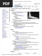 Posterior Tibial Tendon Insufficiency (PTTI) - Foot & Ankle - Orthobullets